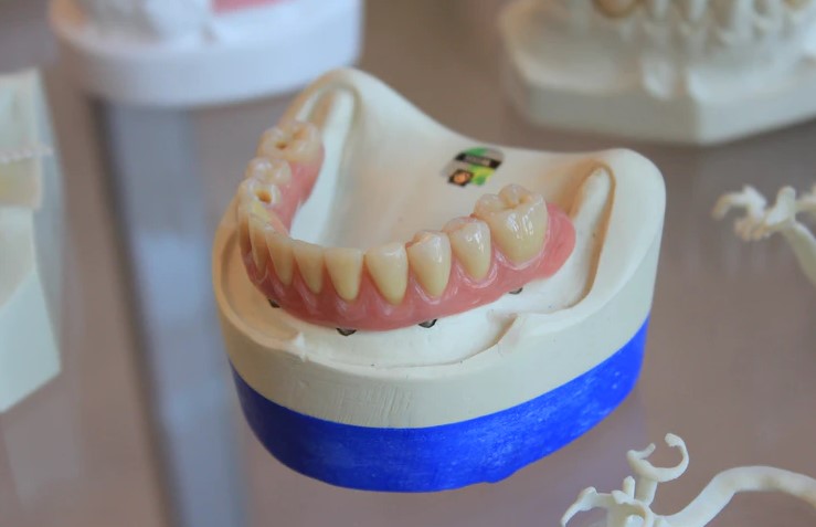 partial dentures cost uk