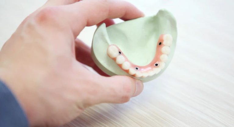 cost of partial Dentures