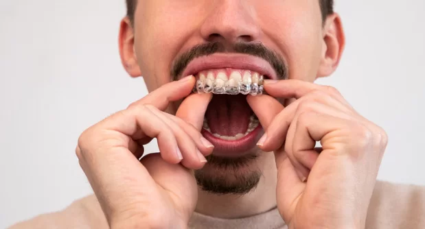 Why go for Inman Aligner