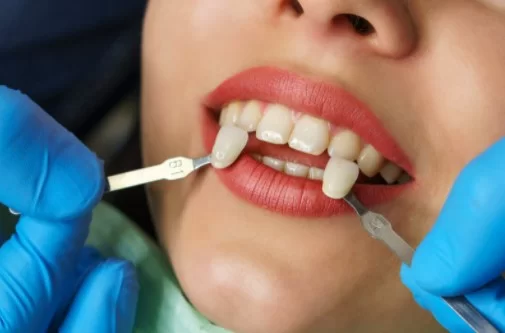 What is Enlighten Teeth Whitening