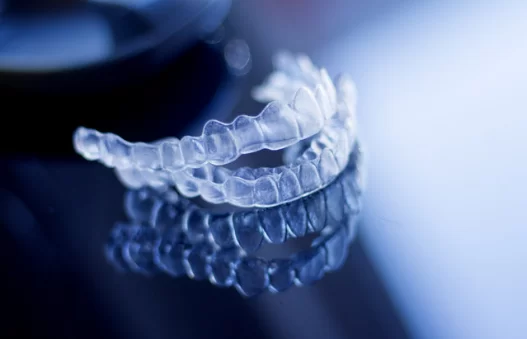 What does Invisalign Cost