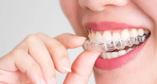 What is the Difference Between Invisalign and Braces
