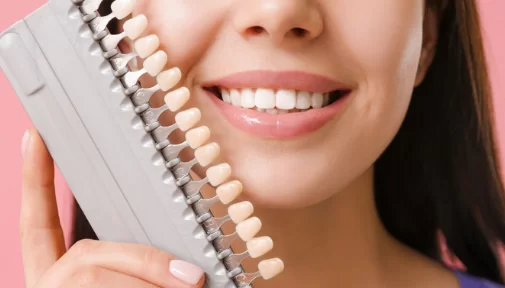 What is Not So Good about Veneers