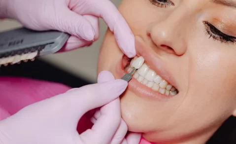 Can composite veneers be removed