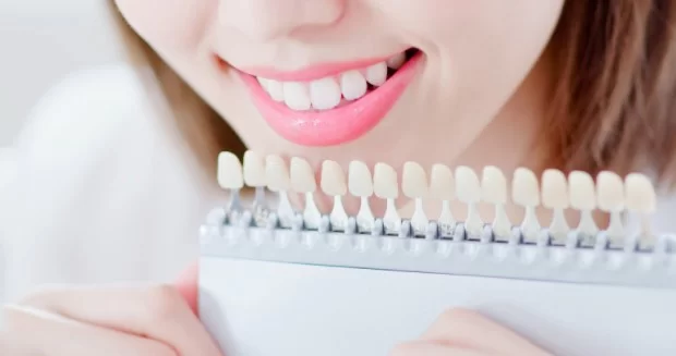 Teeth Whitening cost