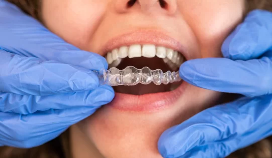 Treatment with Invisalign